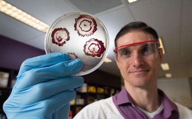 Úc kết hợp 2 loại thuốc sẵn có thành công cụ xuyên thủng màng sinh học của vi khuẩn